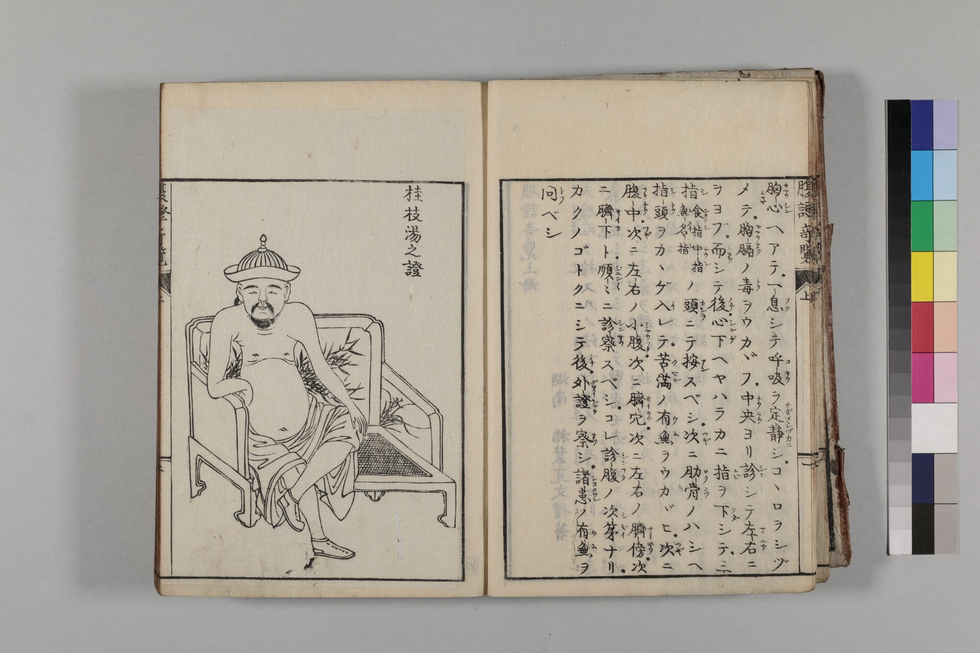 桂枝湯の腹証『腹証奇覧』及び『腹証奇覧翼』より