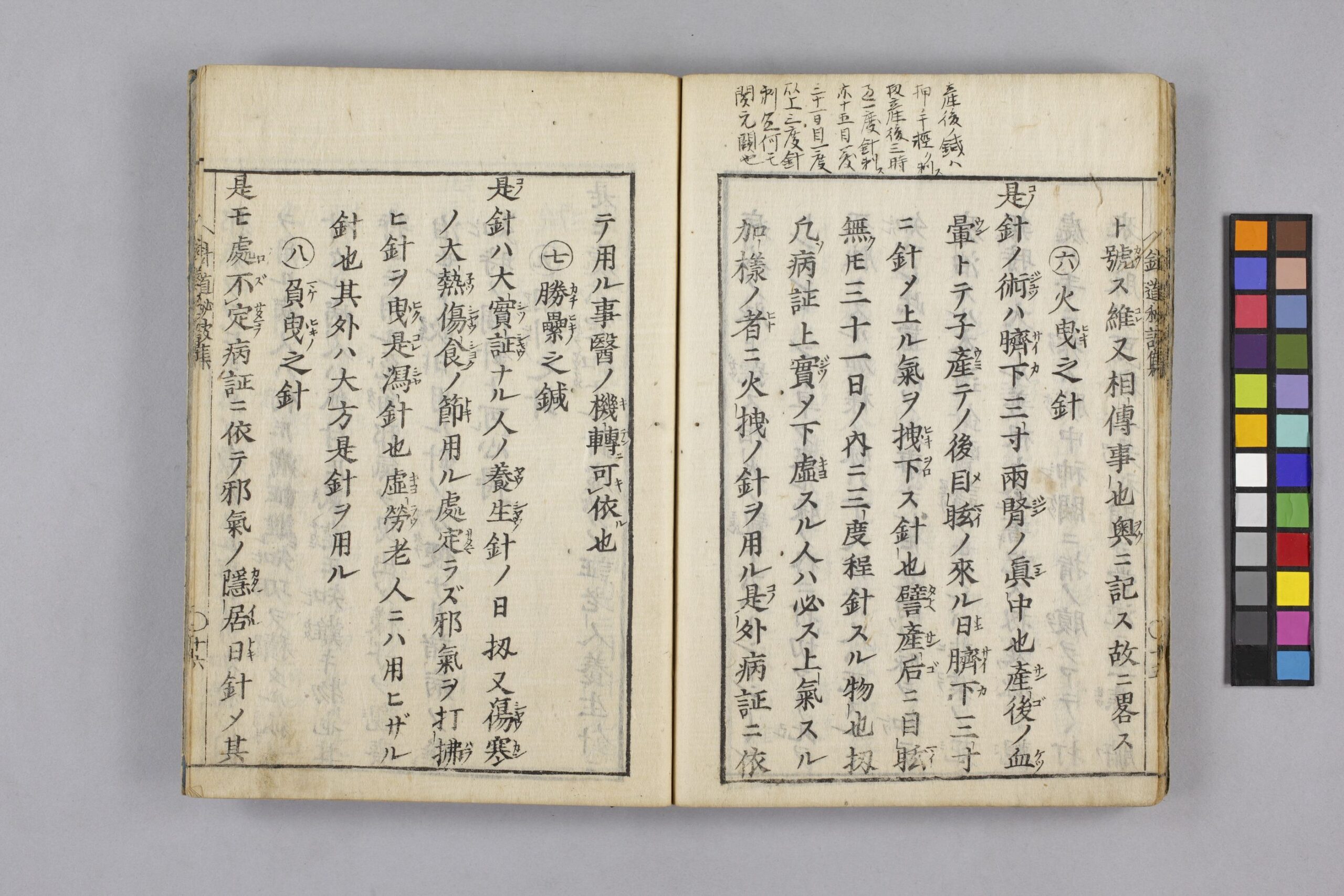 夢分流鍼術・その1